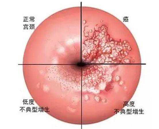 广州供卵 2022广州不孕不育医院排名，附广州生殖医院热门推荐 ‘彩超胚胎形状