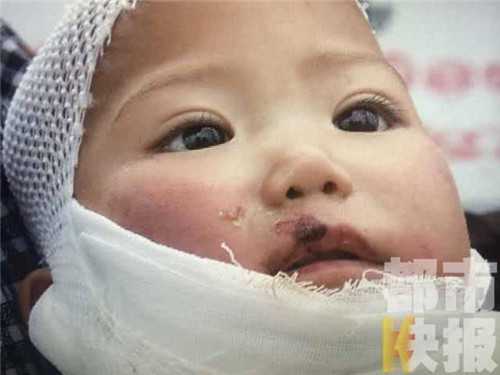 广州哪可以代怀_试管婴儿的龙凤胎的弊端 